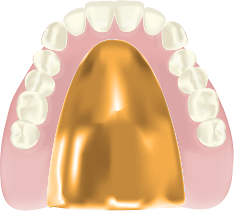金属床